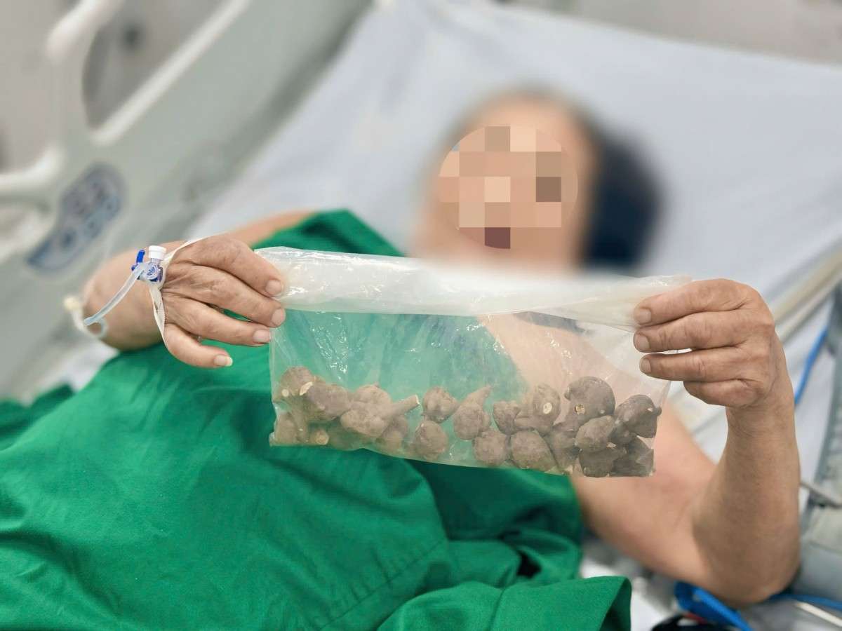 Bệnh nhân ngộ độc nguy kịch do uống củ ấu tầu chưa qua chế biến 4 120251029174853 1